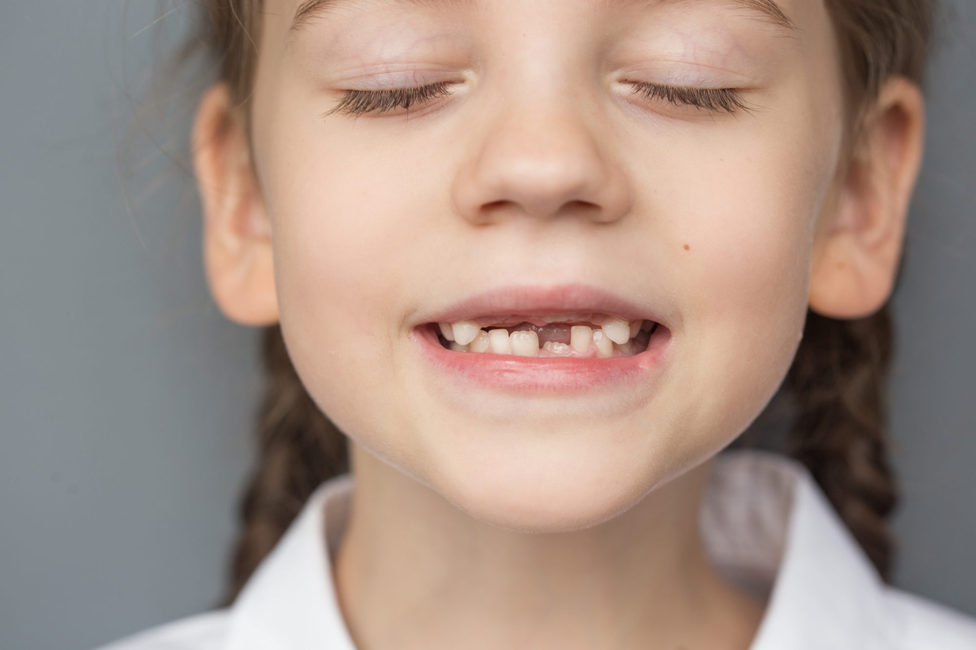 young girl showing off emerging adult teeth is a part of pediatric dentistry